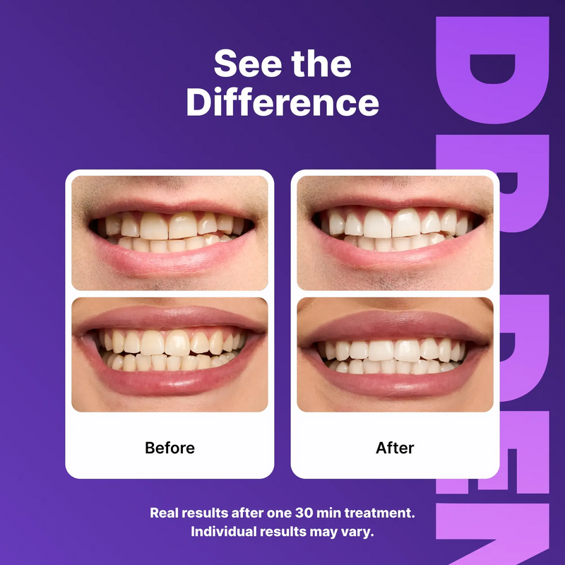 Purple Teeth Whitening Strips