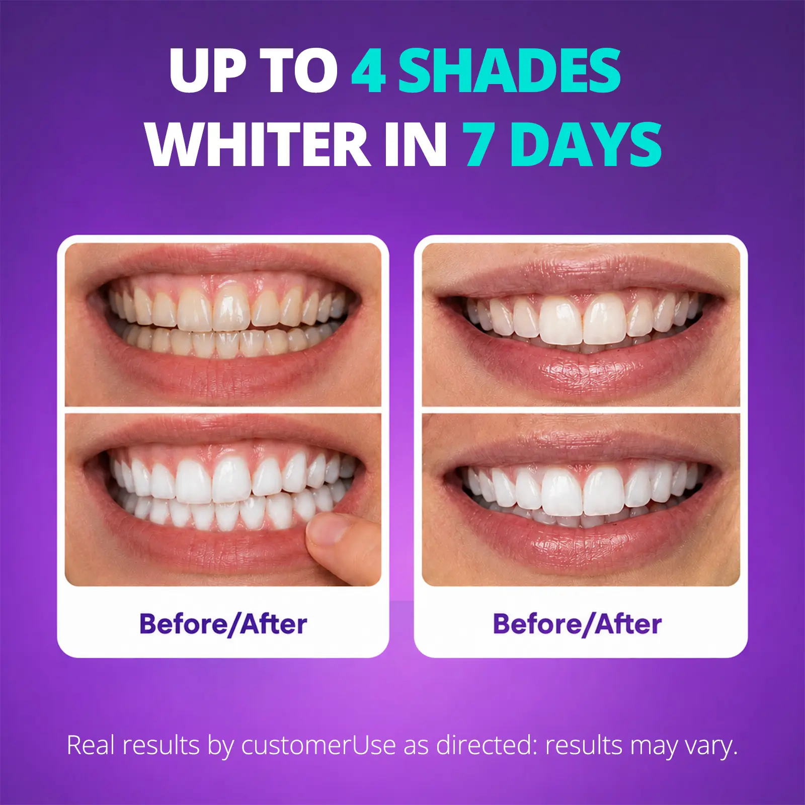 Purple + Hydrogen Peroxide Whitening Strips – Same Enamel-Safe Ingredient Dentists Use | Long-Lasting Results